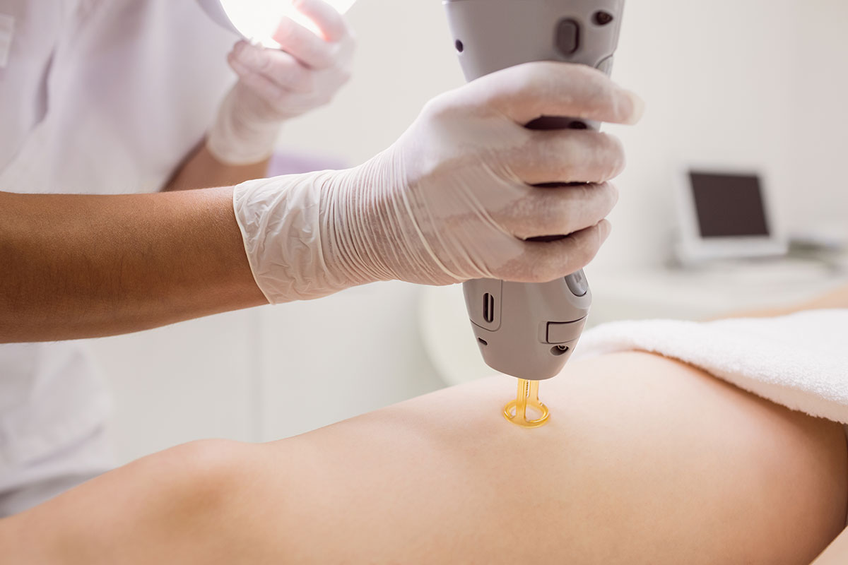 Laser Hair Removal Treatment Harmony Laser Nyc